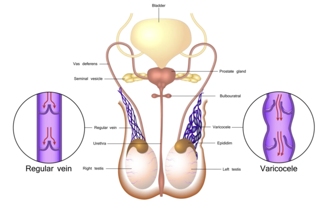 I Farted Through My Penis! Shocking Prostate Surgery Complications Men Need to Know