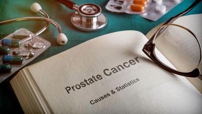 Prostate Cancer.
