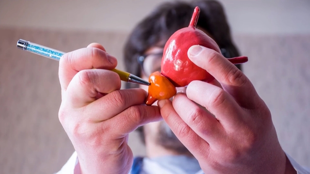What’s a Poop Transplant and Can it Help Prostate Cancer?