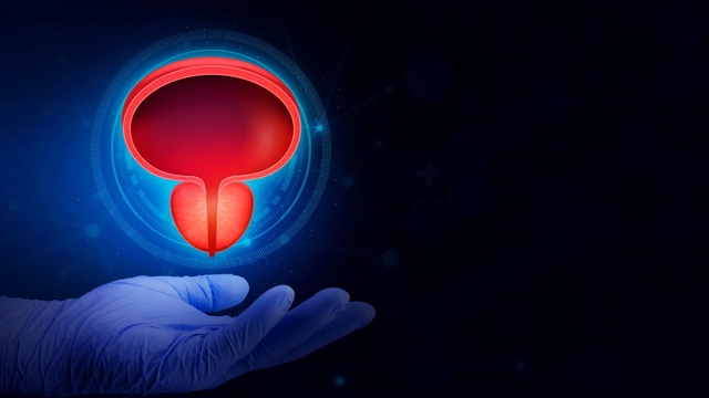 Not All Prostate Cancers Are the Same.
