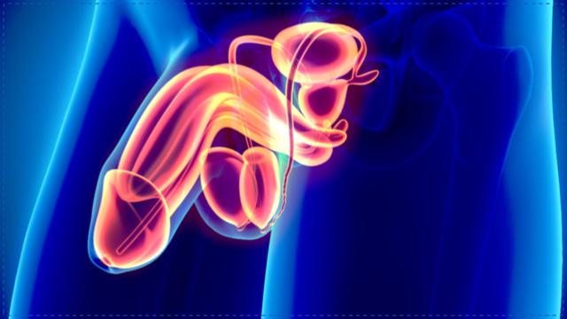 10 Best Things You Can Do to Avoid Prostate Cancer &mdash; or Any Cancer at All