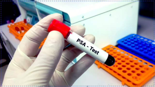 10 Best Things You Can Do to Avoid Prostate Cancer &mdash; or Any Cancer at All