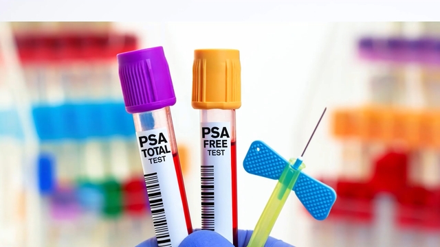 PSA Is Not a Cancer Test &ndash; So Why Are Men Losing Their Prostates Because of It&##x3f;