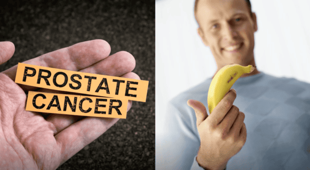 The Three Hammers&##x3a; Why Every Man Must Think Twice Before Surrendering to Prostate Cancer Treatment