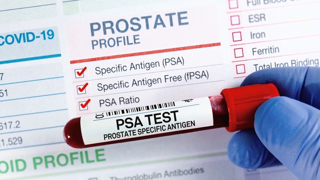 Control the Response, Not the Number&##x3a; A Smarter Way to Think About PSA and Stress