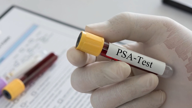 Recently diagnosed with Prostate Cancer&##x3f;